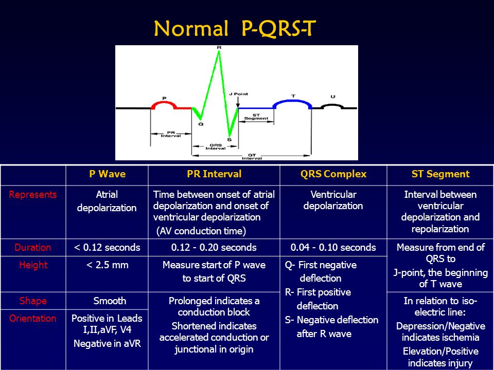 ECG interpretation: Characteristics of the normal ECG (P-wave, QRS complex,  ST segment, T-wave) – ECG & ECHO