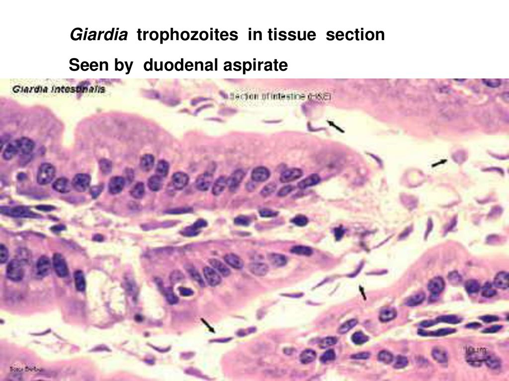 Giardia duodenal aspirate - chuggington.hu