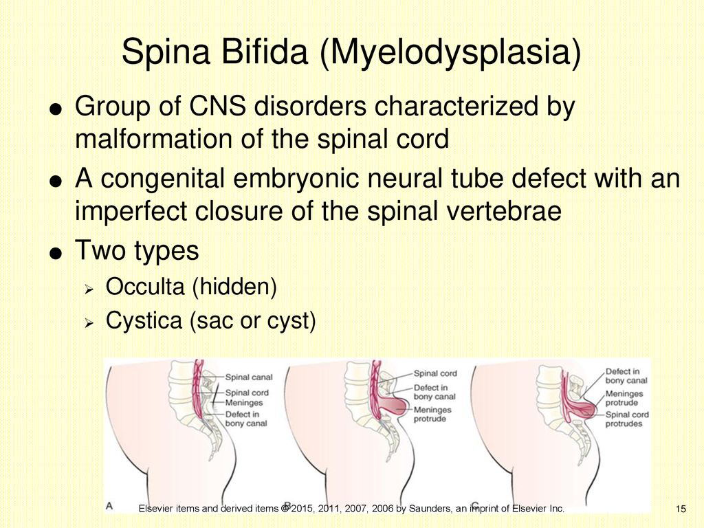 The Newborn with a Perinatal Injury or Congenital Malformation - ppt ...