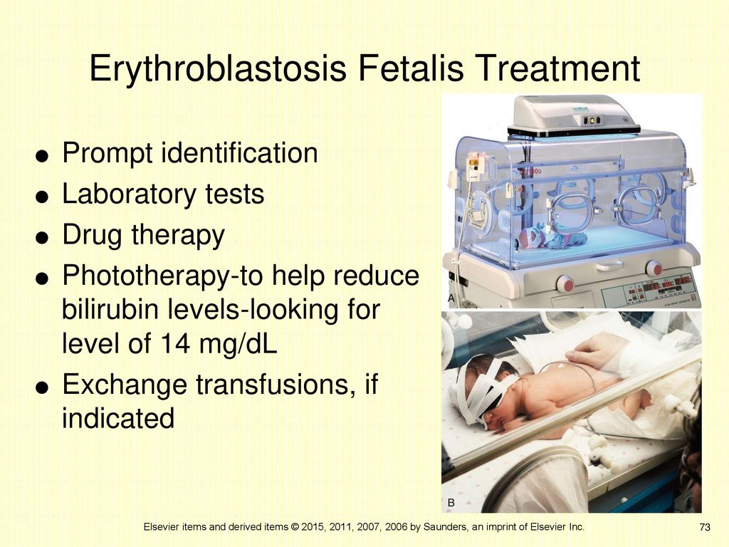 Erythroblastosis Fetalis Treatment