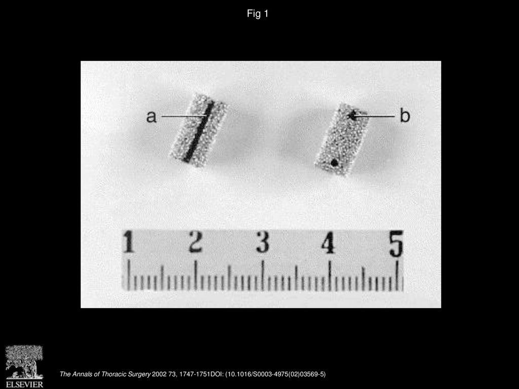 Fig 1 Final appearance of the titanium prosthesis with (a) longitudinal slot and (b) holes at the extremities of each tube.