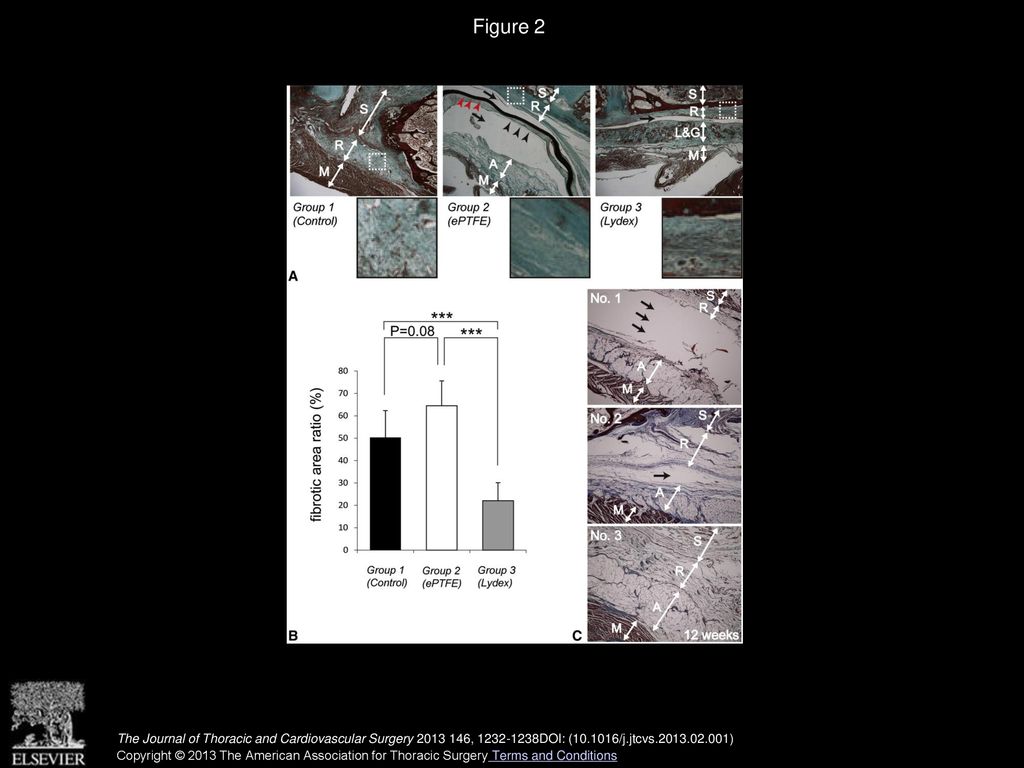 Prevention Of Retrosternal Adhesion By Novel Biocompatible Glue Derived From Food Additives