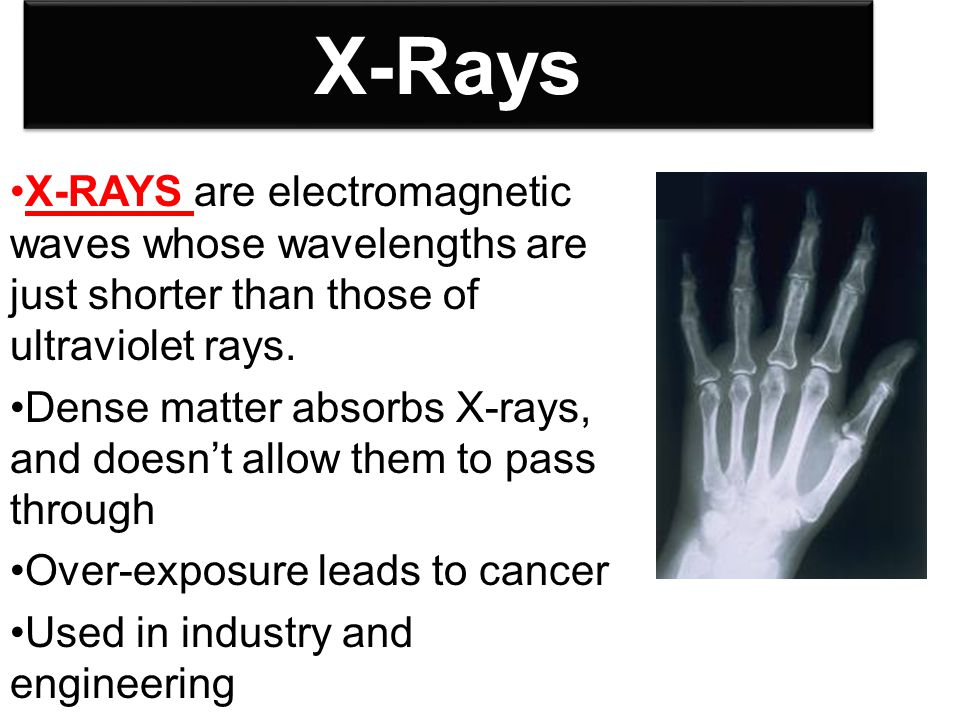 X-Rays X-RAYS are electromagnetic waves whose wavelengths are just shorter than those of ultraviolet rays.