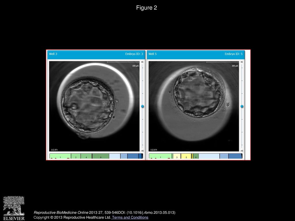 New approaches to embryo selection Biology Diagrams
