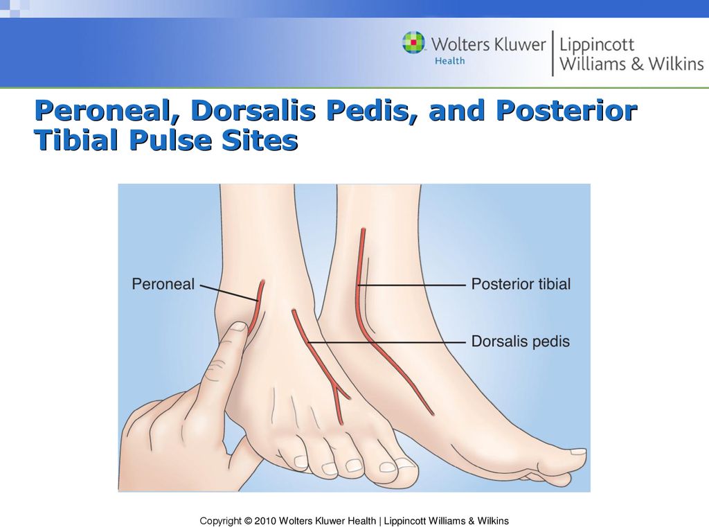 Chapter 31 Assessment And Management Of Patients With Vascular Disorders And Problems Of Peripheral Circulation Ppt Download