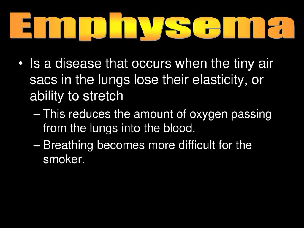 Emphysema Is a disease that occurs when the tiny air sacs in the lungs lose their elasticity, or ability to stretch.