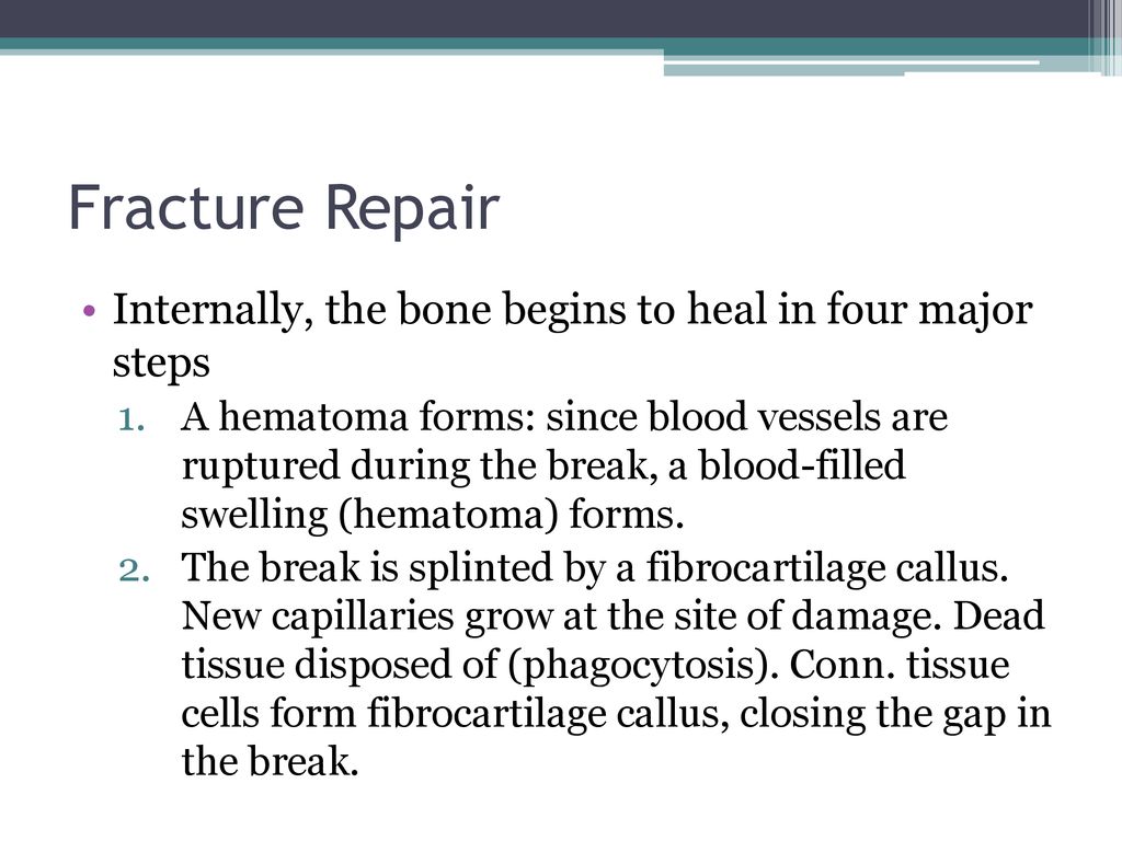 Fracture Repair Internally, the bone begins to heal in four major steps.