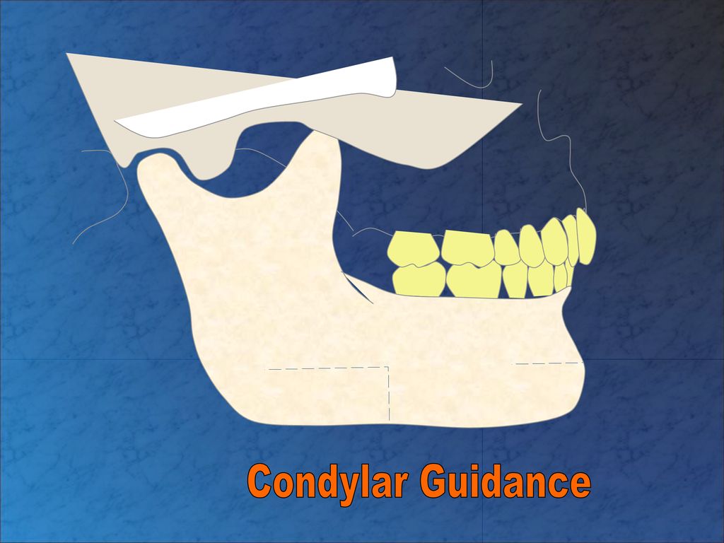 Muscles of mastication ppt download