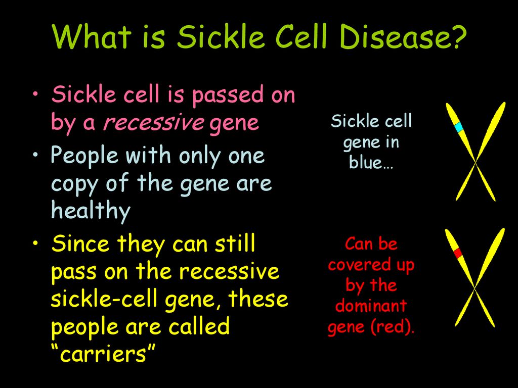 What is Sickle Cell Disease