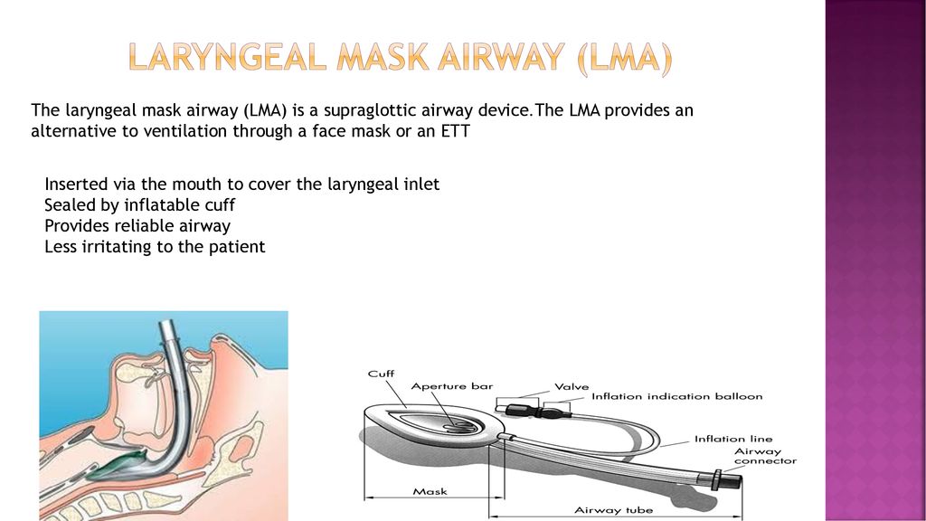 EQUIPMENT OF INTUBATION - ppt download