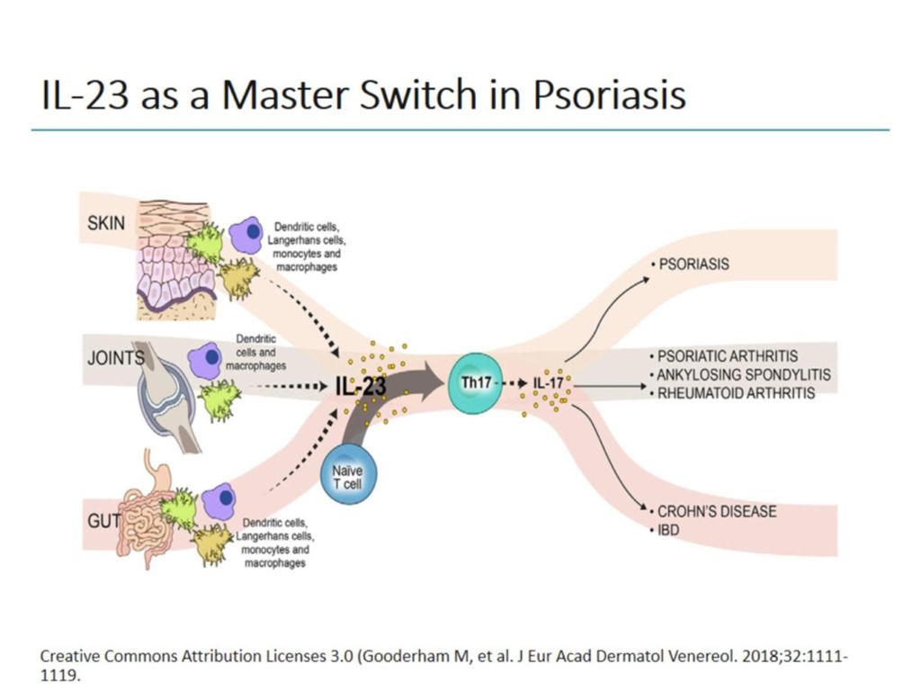 Targeting Il 23 For Therapeutic Longevity In Psoriasis Ppt Download Targeting Il 23 For Therapeutic Longevity In Psoriasis Ppt Download
