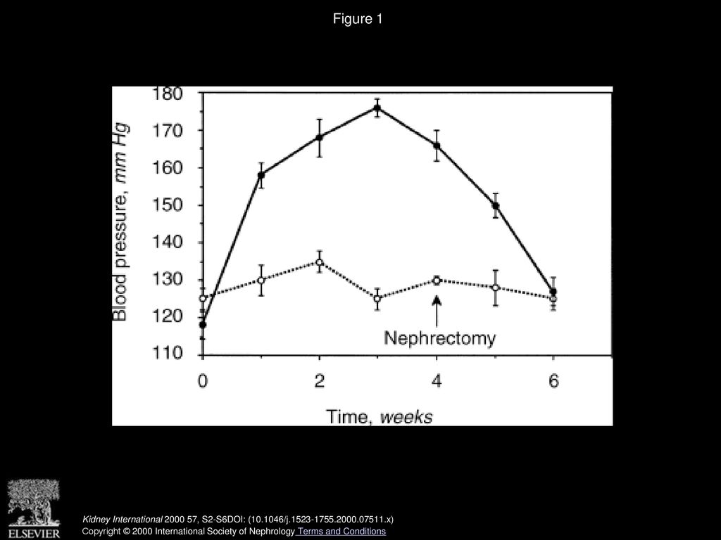 Neurogenic Factors And Hypertension In Renal Disease Ppt Download neurogenic-factors-and-hypertension-in-renal-disease-ppt-download