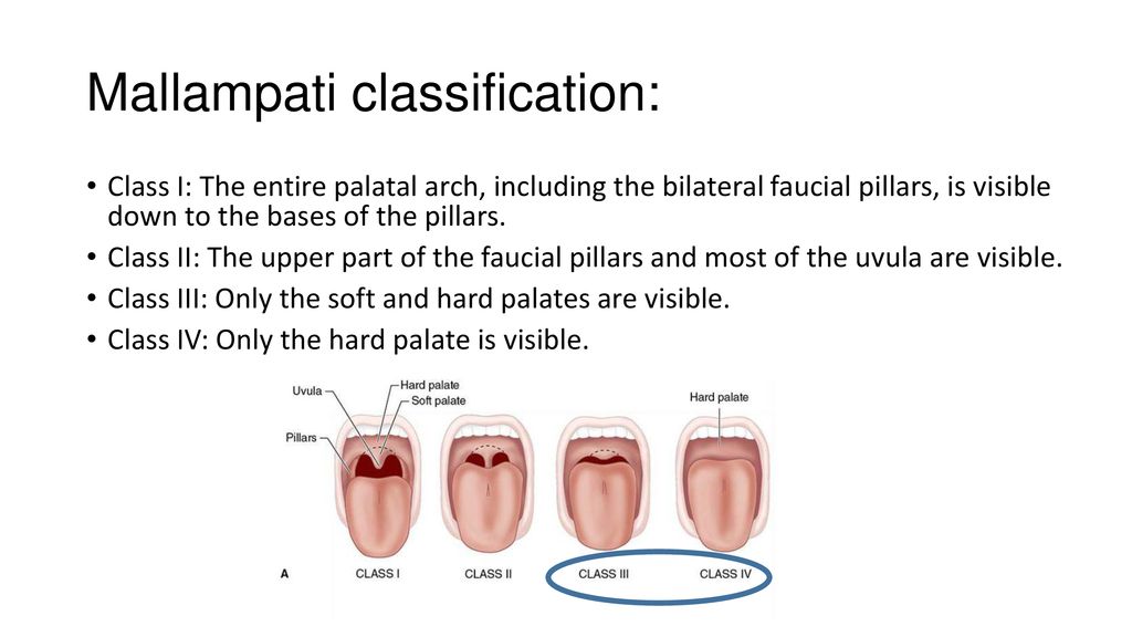 Intubation and Anatomy of the Airway And Anesthesia apparatus - ppt ...