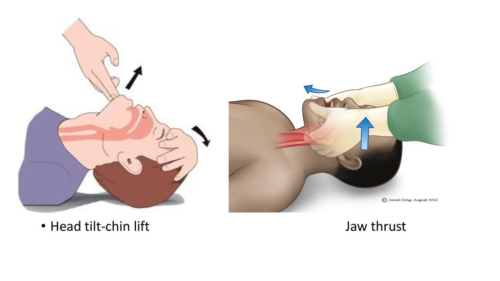 Intubation and Anatomy of the Airway And Anesthesia apparatus - ppt ...