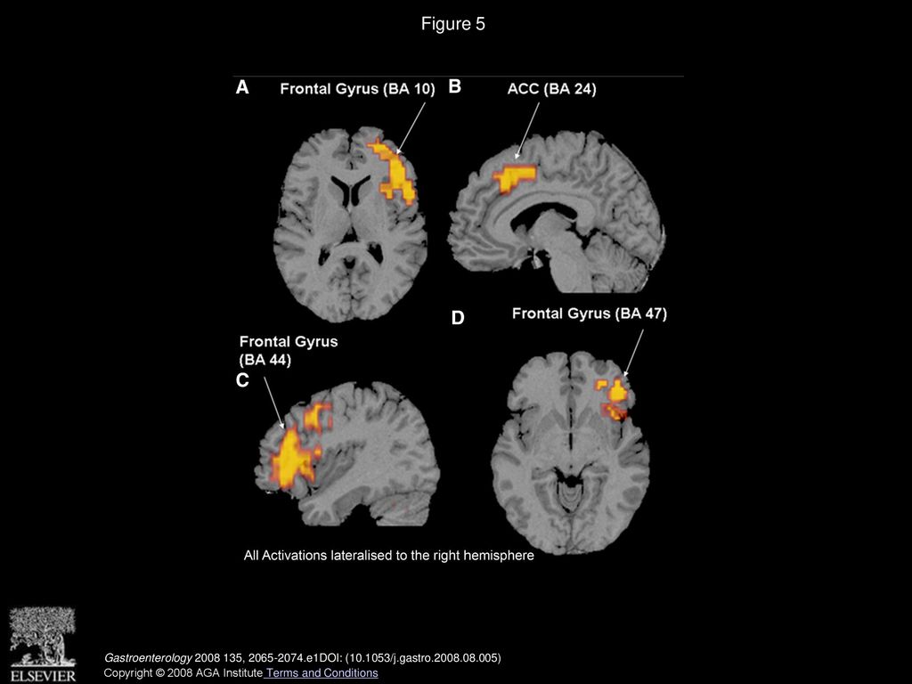 Volume 135, Issue 6, Pages e1 (December 2008) - ppt download