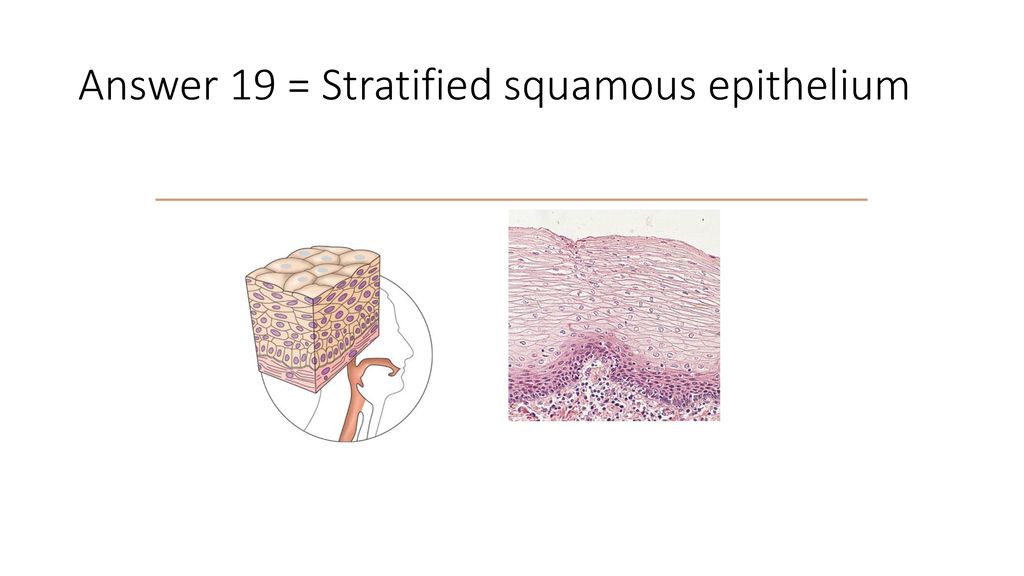 Answer 19 = Stratified squamous epithelium