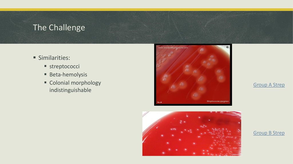 The Challenge Similarities: streptococci Beta-hemolysis