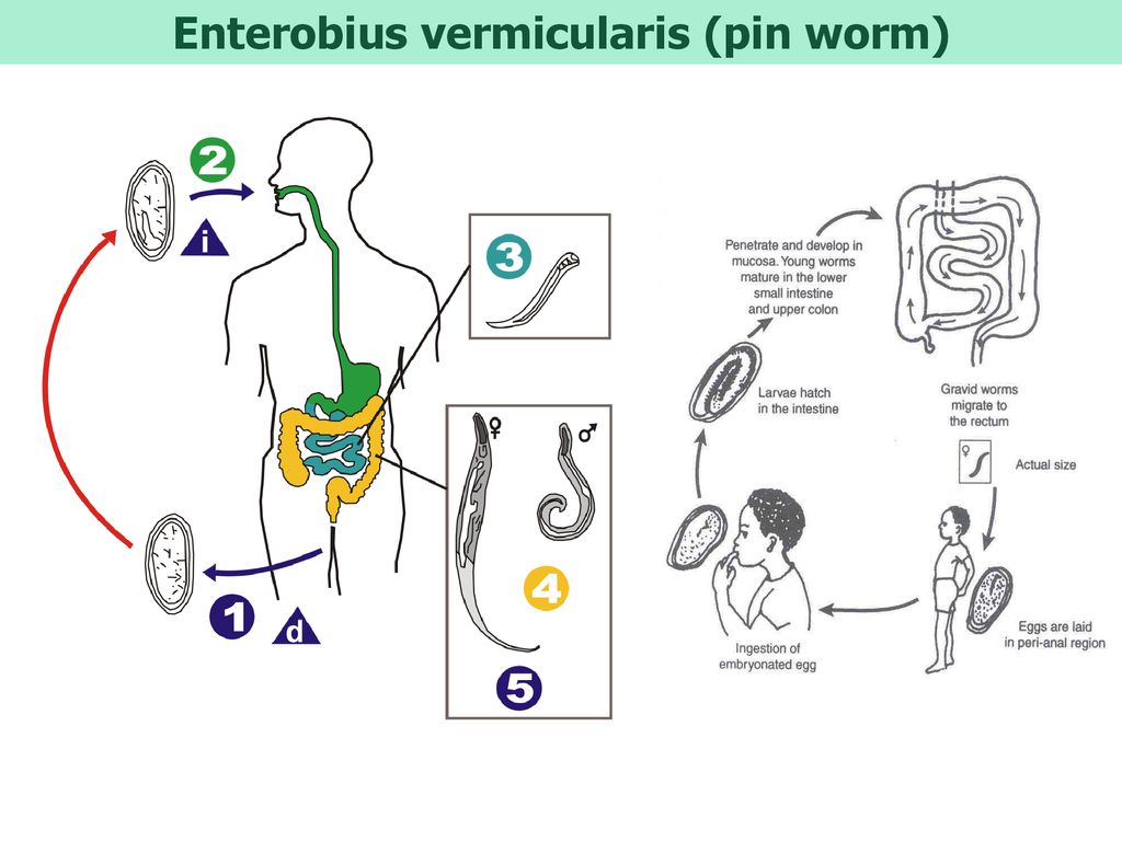 enterobius vermicularis tojás címkézett ábra)
