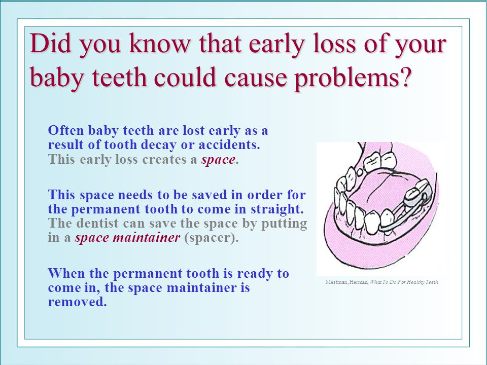 Did you know that early loss of your baby teeth could cause problems