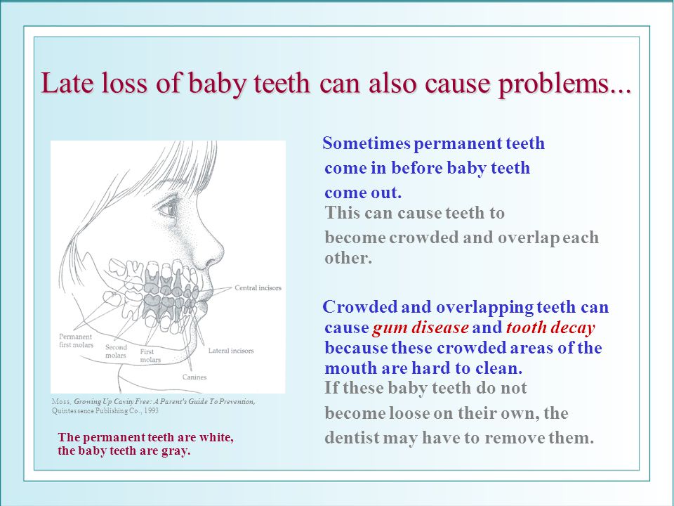 Late loss of baby teeth can also cause problems...