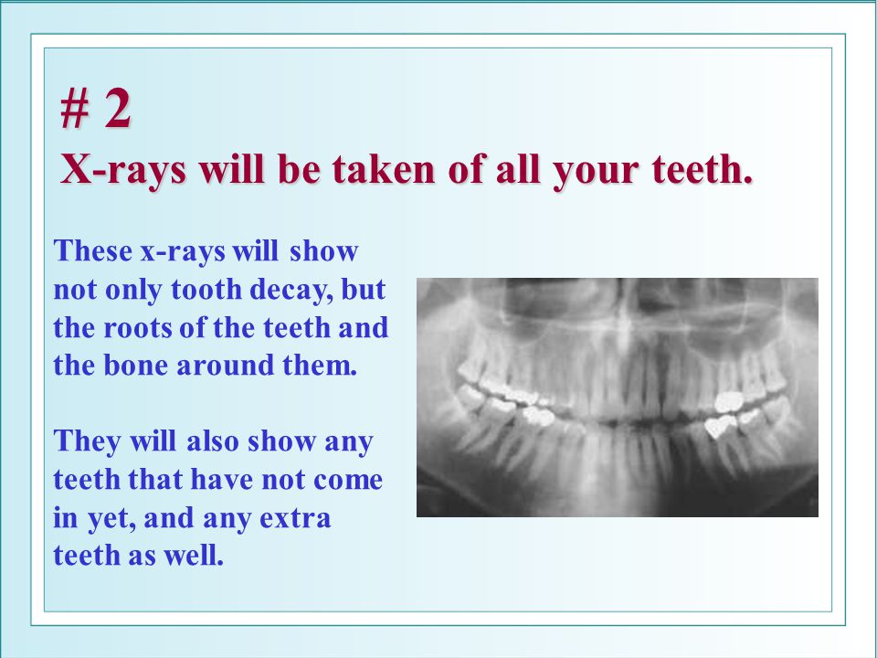 # 2 X-rays will be taken of all your teeth.