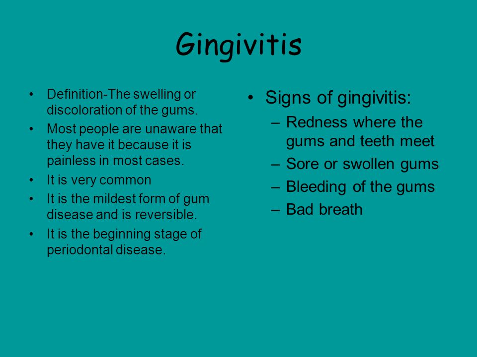 Gingivitis Signs of gingivitis: Redness where the gums and teeth meet