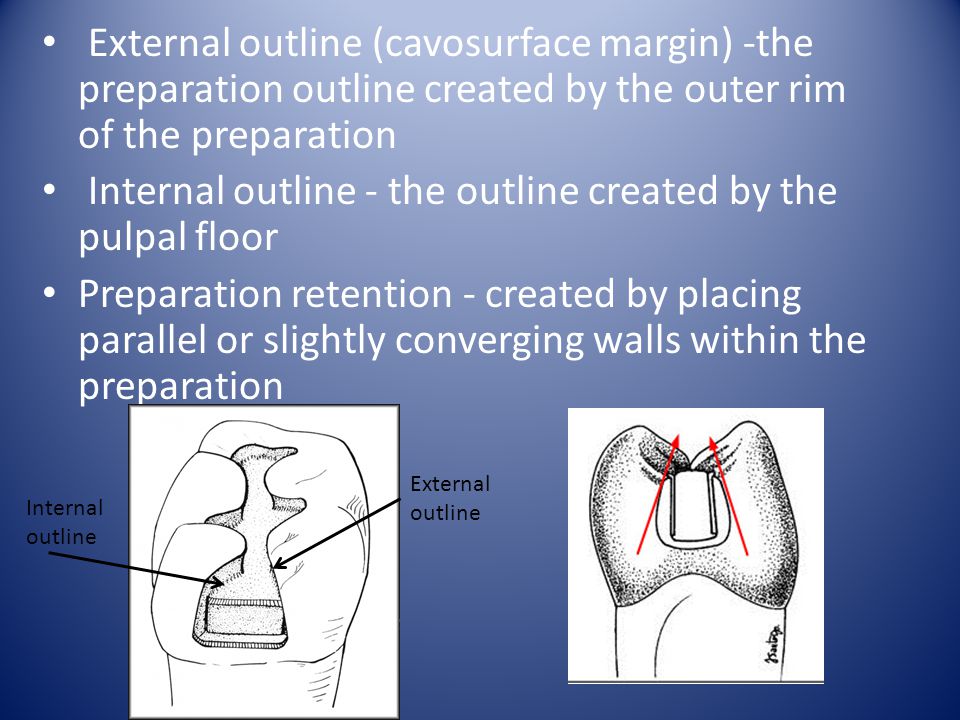 Internal outline - the outline created by the pulpal floor