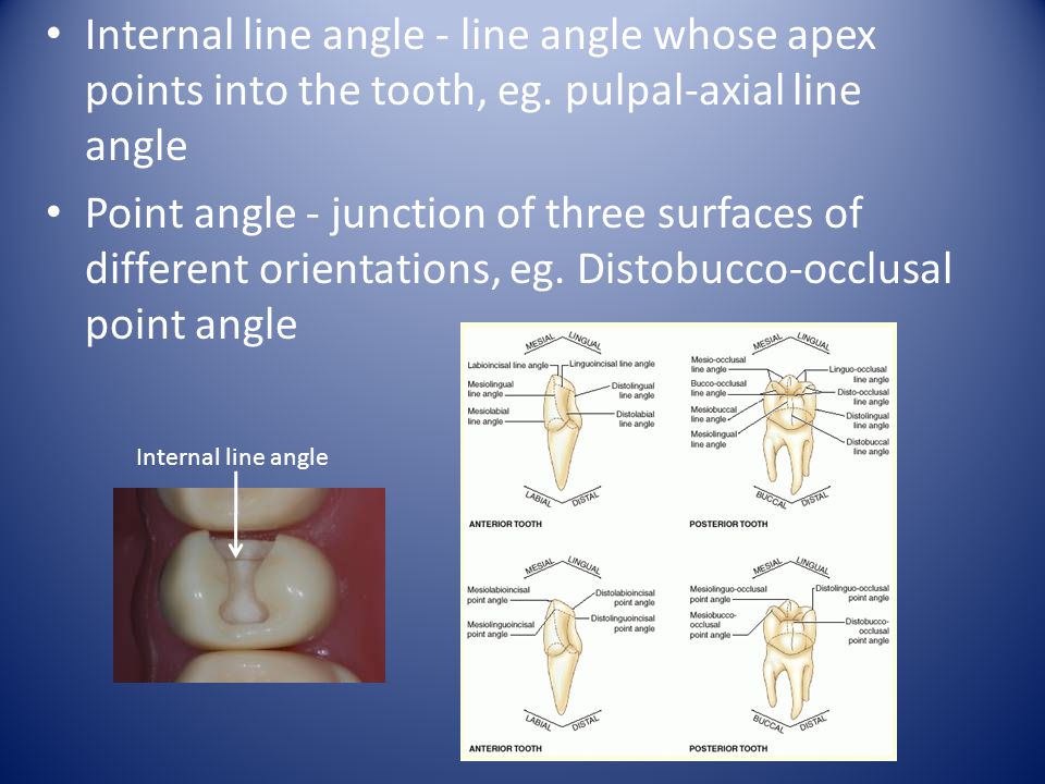Internal line angle - line angle whose apex points into the tooth, eg
