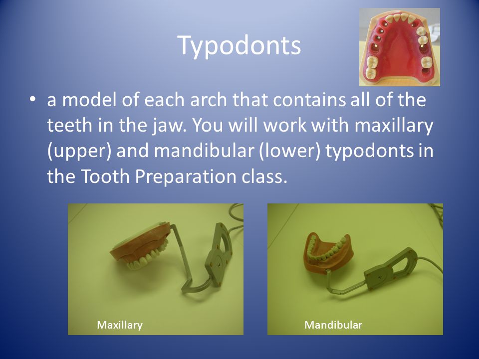 Typodonts
