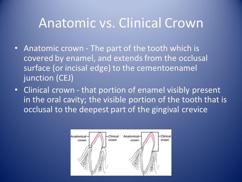 Anatomic vs. Clinical Crown