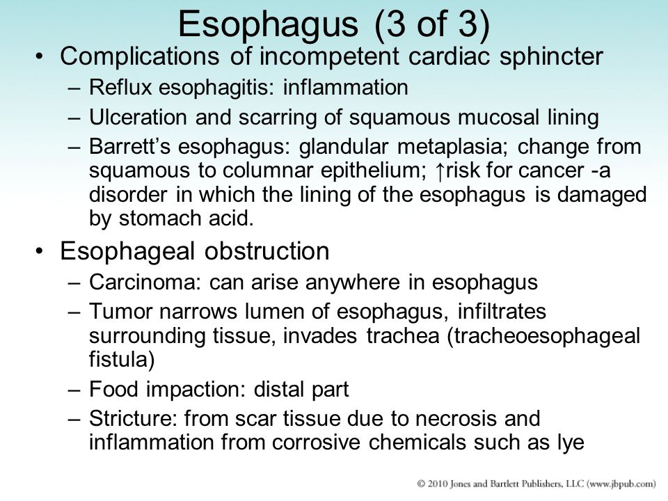 Esophagus (3 of 3) Complications of incompetent cardiac sphincter