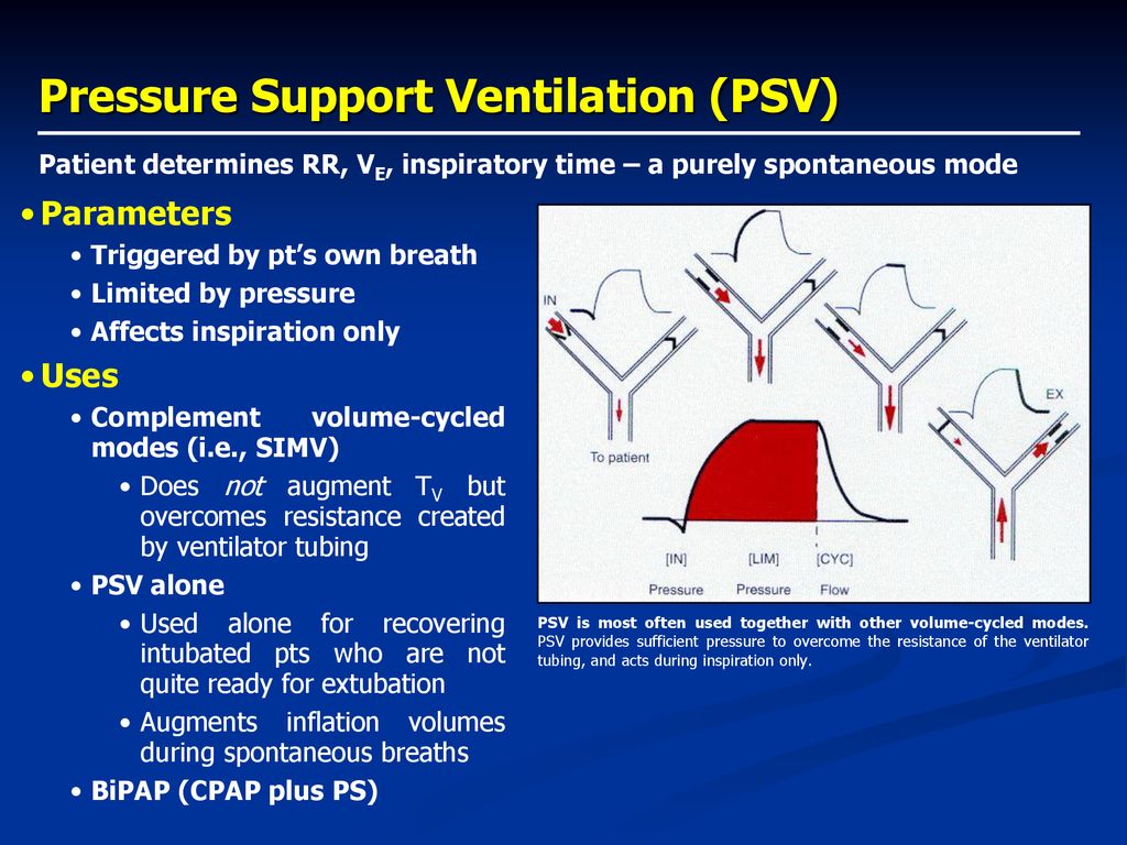 Principles Of Mechanical Ventilation - Ppt Download