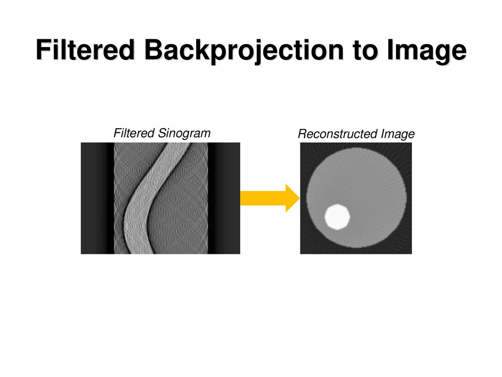 Filtered Backprojection to Image