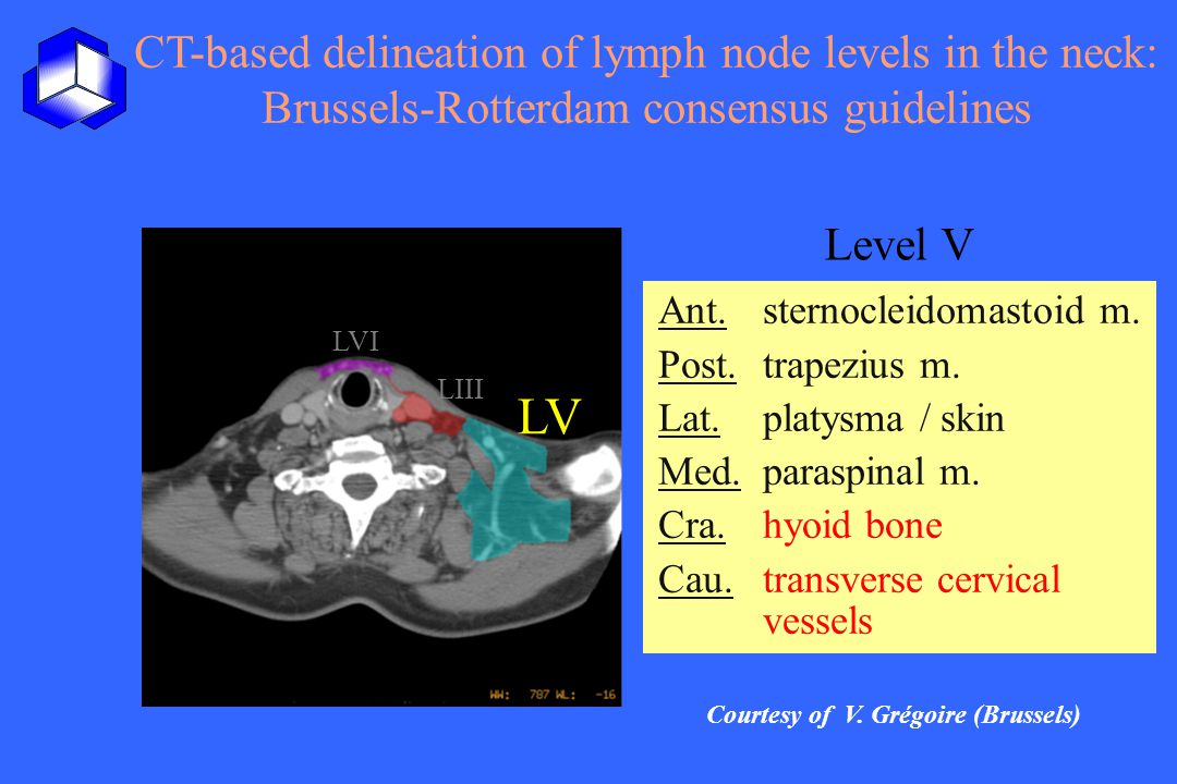 CT-based delineation of lymph node levels in the neck: Brussels-Rotterdam consensus guidelines