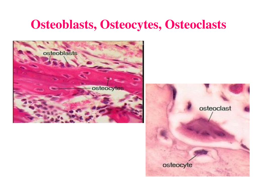 Introduction to the Skeletal System – Bone Tissue (Chapter 6) - ppt ...