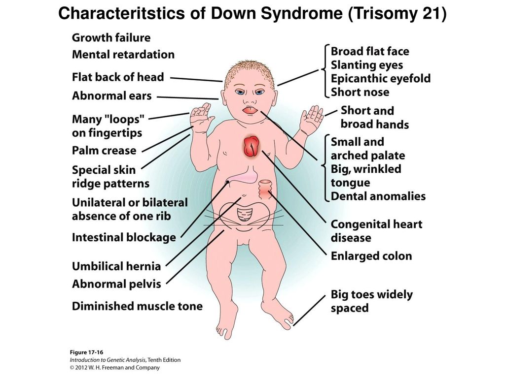 Down Syndrome Pussy