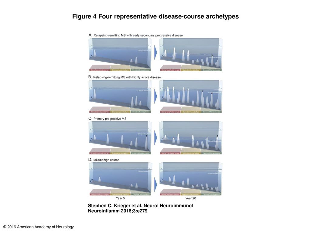 Figure 4 Four representative disease-course archetypes