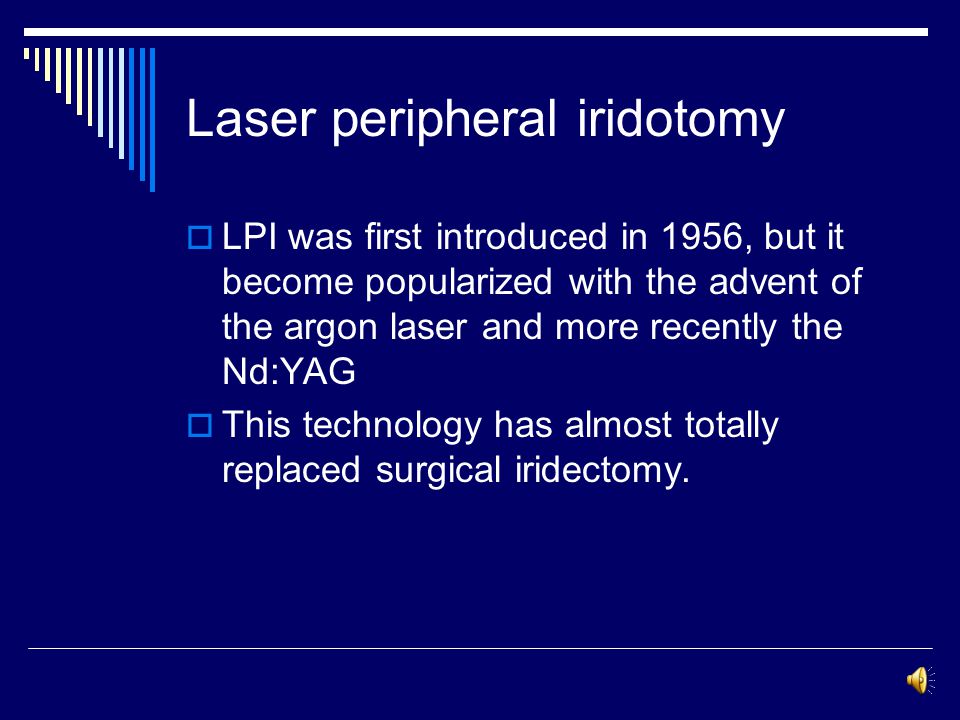 Laser treatment in glaucoma - ppt video online download