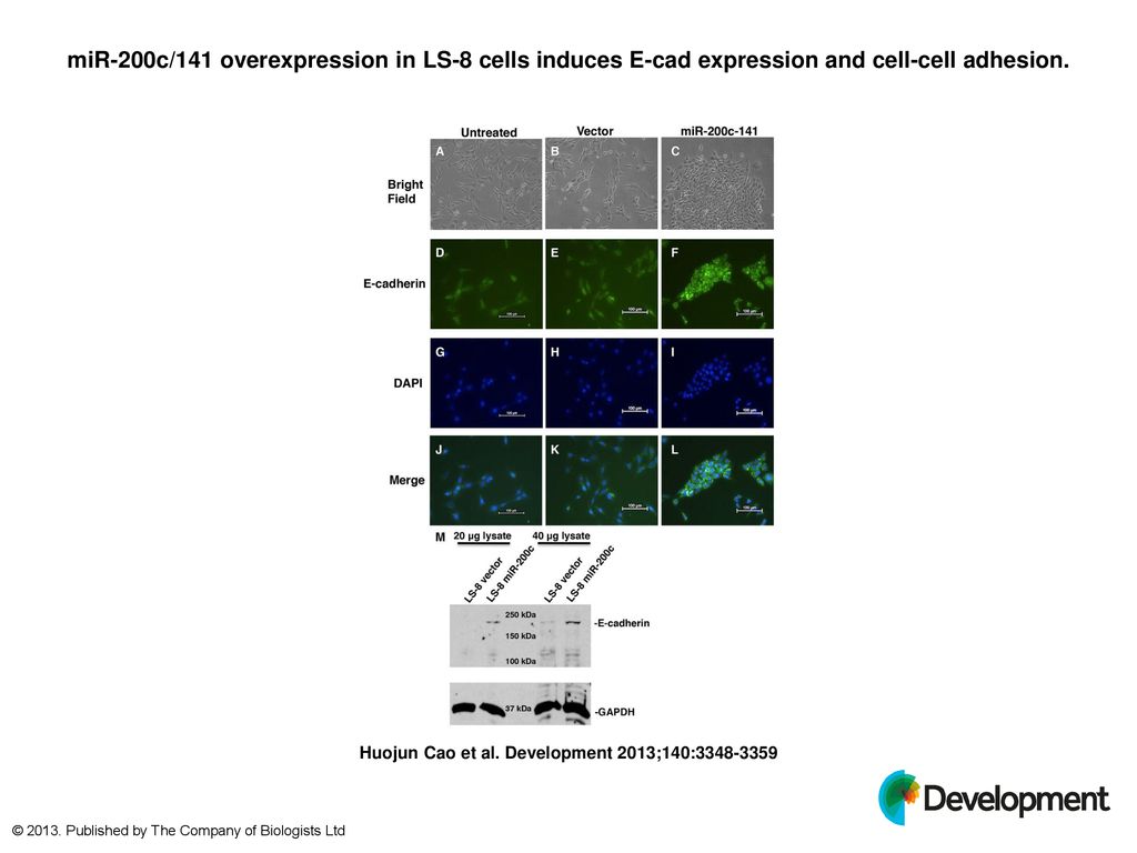 miR-200c/141 overexpression in LS-8 cells induces E-cad expression and cell-cell adhesion.