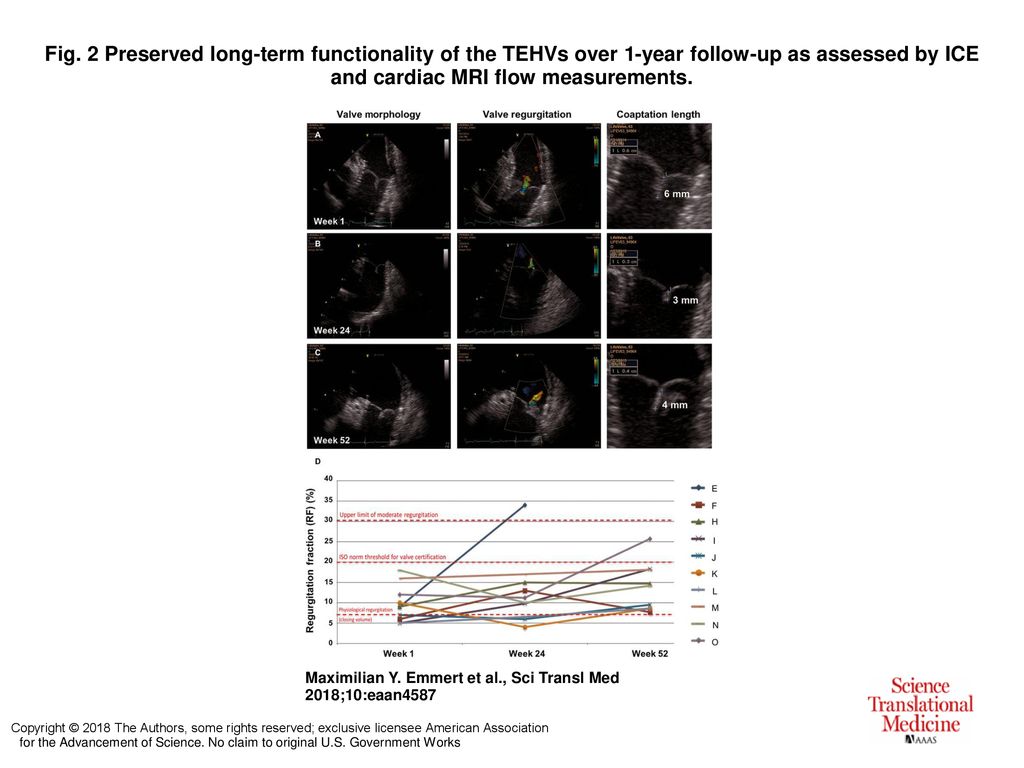 Fig. 2 Preserved long-term functionality of the TEHVs over 1-year follow-up as assessed by ICE and cardiac MRI flow measurements.