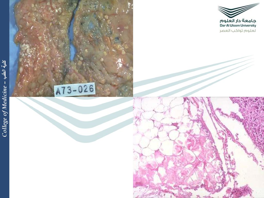 FREE RADICAL INJURY, TYPES OF NECROSIS AND APOPTOSIS ppt download