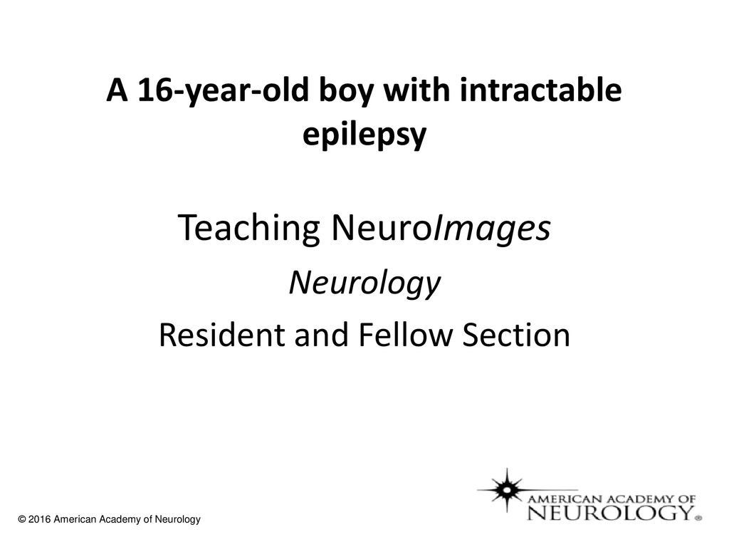 a-16-year-old-boy-with-intractable-epilepsy-ppt-download