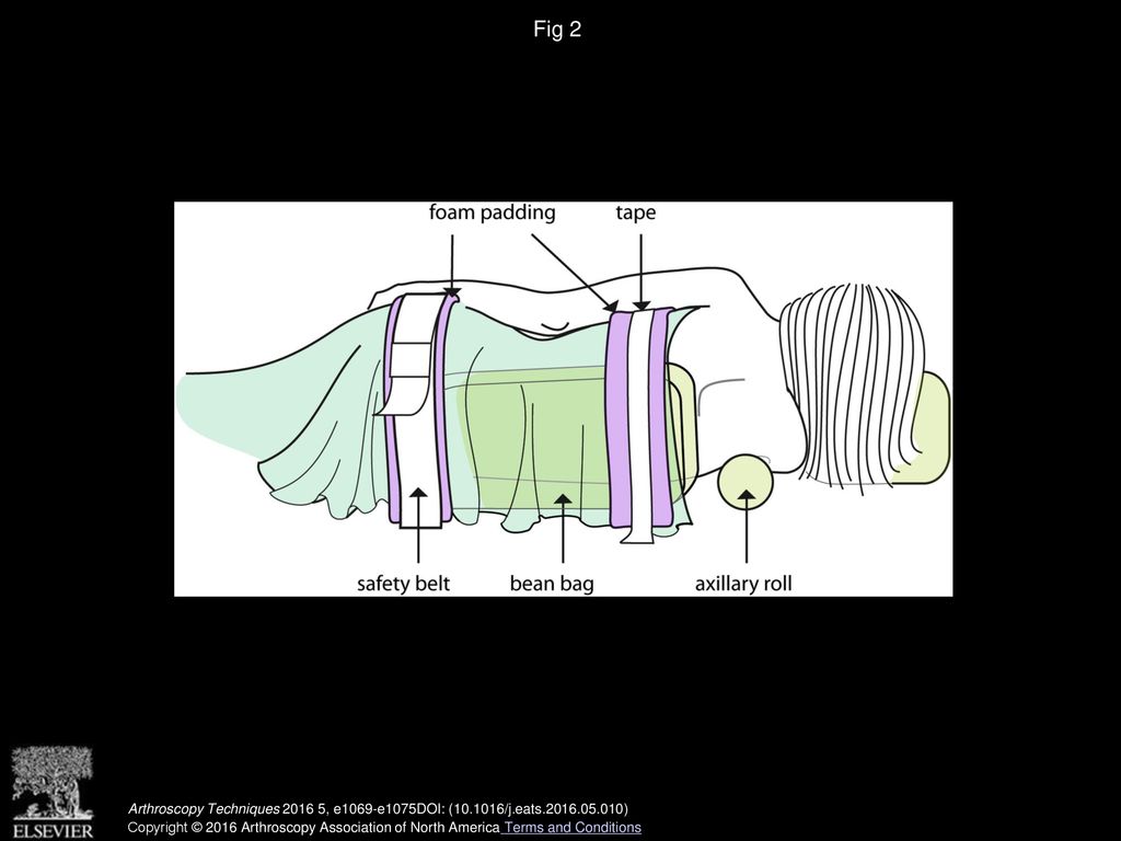 Basic Shoulder Arthroscopy Lateral Decubitus Patient Positioning ppt download