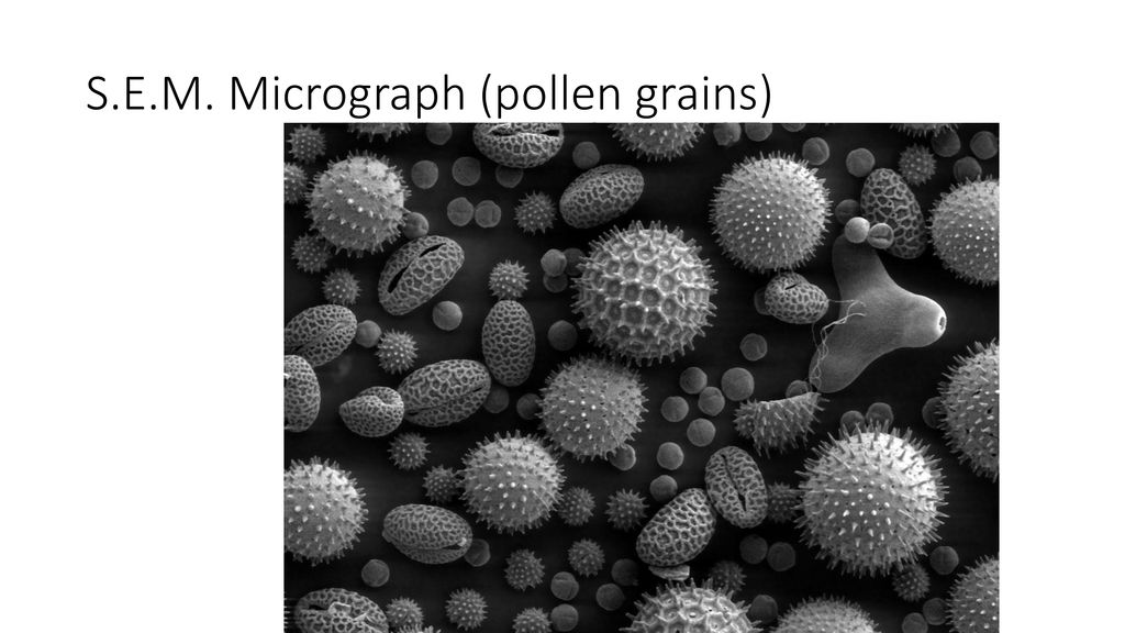 Исследование пыльцы. Пыльца амброзии под микроскопом. Пыльца растений под микроскопом. Микробы под микроскопом для детей. Пыльца под электронным микроскопом.
