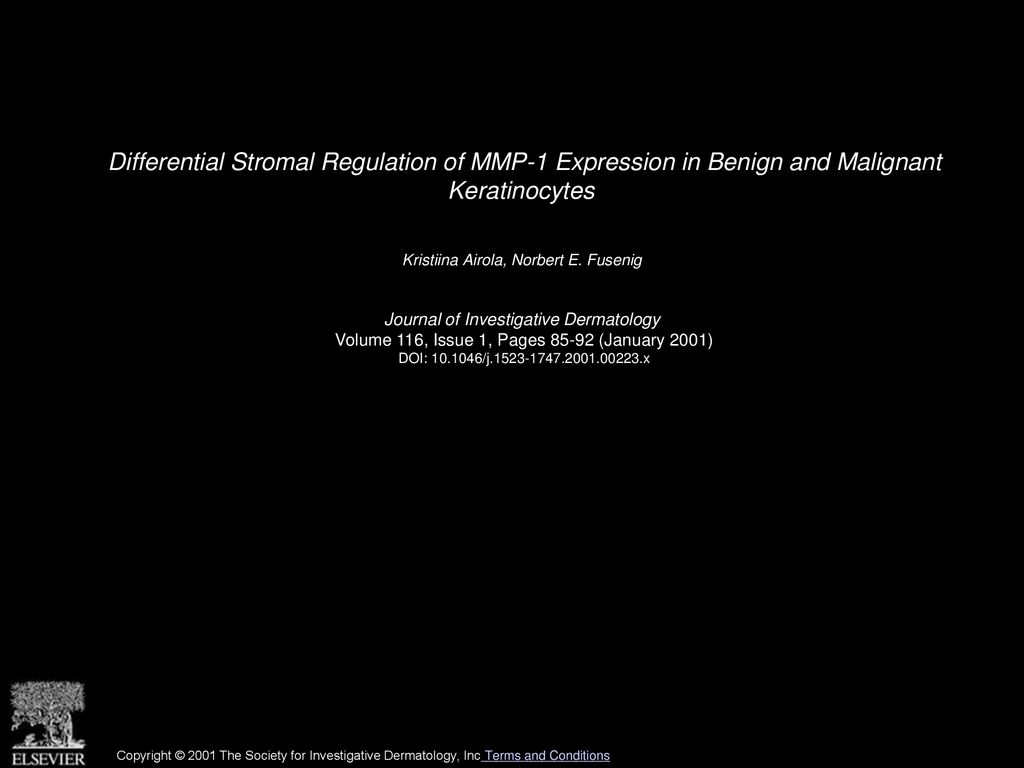Differential Stromal Regulation of MMP-1 Expression in Benign and Malignant Keratinocytes