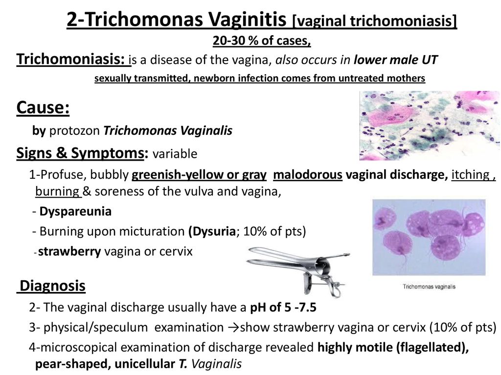 Trichomoniázis tünetei és kezelése