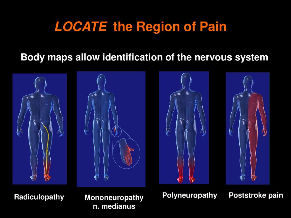 LOCATE the Region of Pain