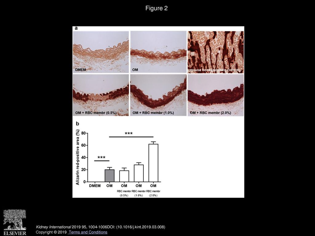 Figure 3 From Lysed Erythrocyte Membranes Promote Vascular