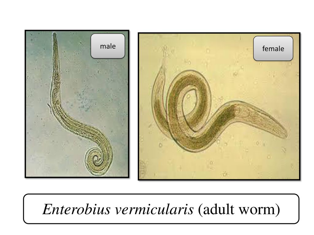 az enterobius vermicularis volt ist das