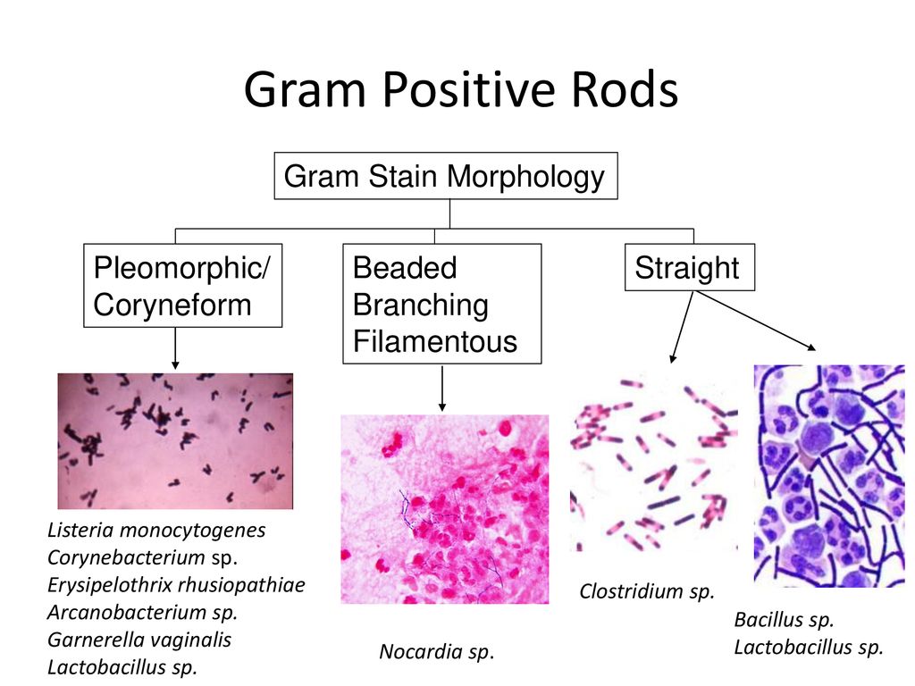 wallpapers Listeria Monocytogenes Gram Stain Morphology the gram positive rods and aerobic
